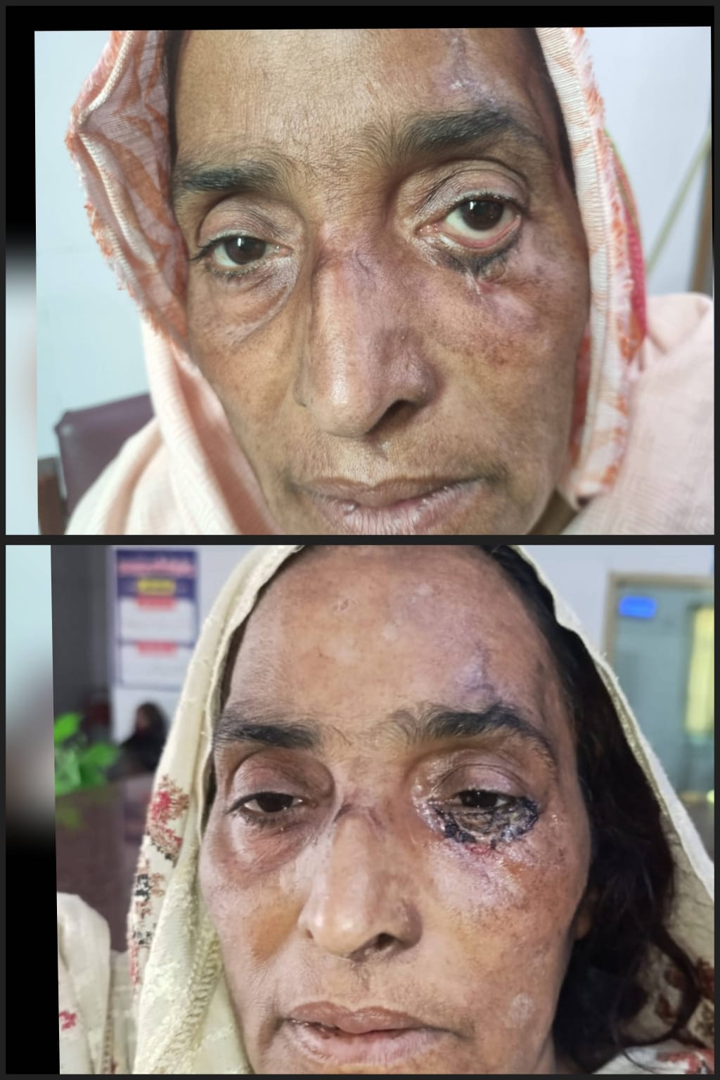 Before & After 11